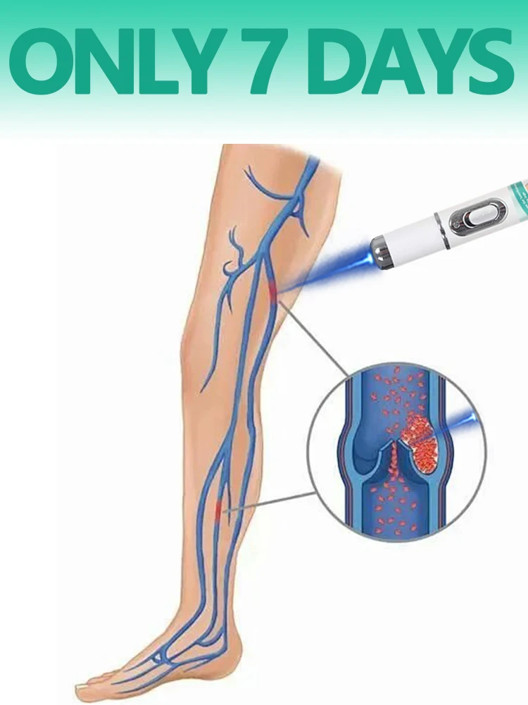 

Ручка с синим светом 2025 года. Приходите всю вену в течение 7 дней.