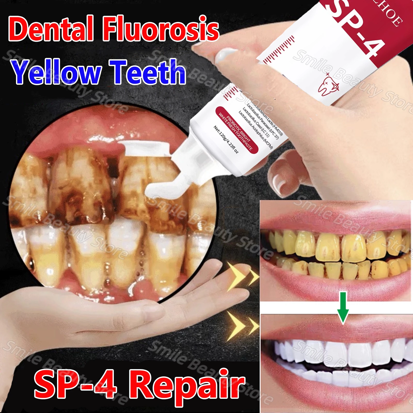 

120g Probiotic Toothpaste SP-4 Whitening Tooth Remove Plaque Stains Teeth Whitener Oral Hygiene Clean Fresh Breath Dental Tools