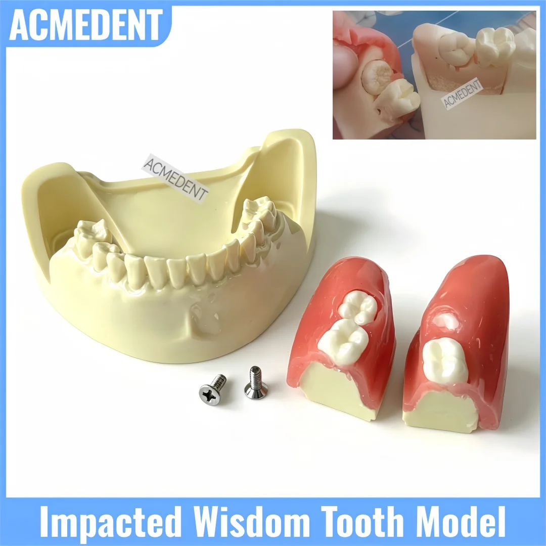 

Модель зуба с имплантатом для отработки навыков удаления прорезывающихся зубов, многоразовый тренажер из полимерного материала