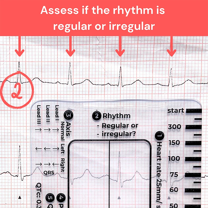 2025 Nuovo righello ECG a 7 fasi Nuova cancelleria regalo creativa per amici, compagni di classe e bambini