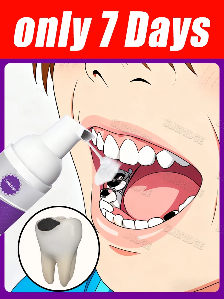 

2025 hotsale New upgrade 3.0 Intraoral Mousse clean tools,Highly Rated,unisex,Free shipping