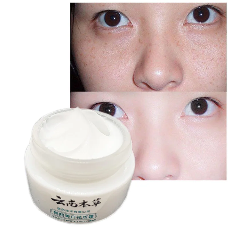 

20g Whitening Freckles Cream Remove Melasma Dark Spots Dressing Face Lighten Melanin Cream Moisturizing Brightening Skin Care