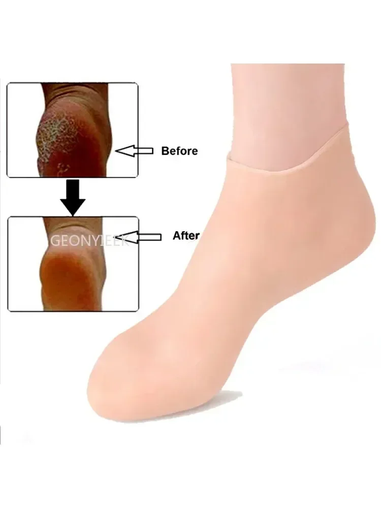 Chaussettes de soin des pieds en silicone, gel hydratant anti-Contation, dissolvant de peau à fréquence, protecteur, outil de soin des pieds, oto Instituts