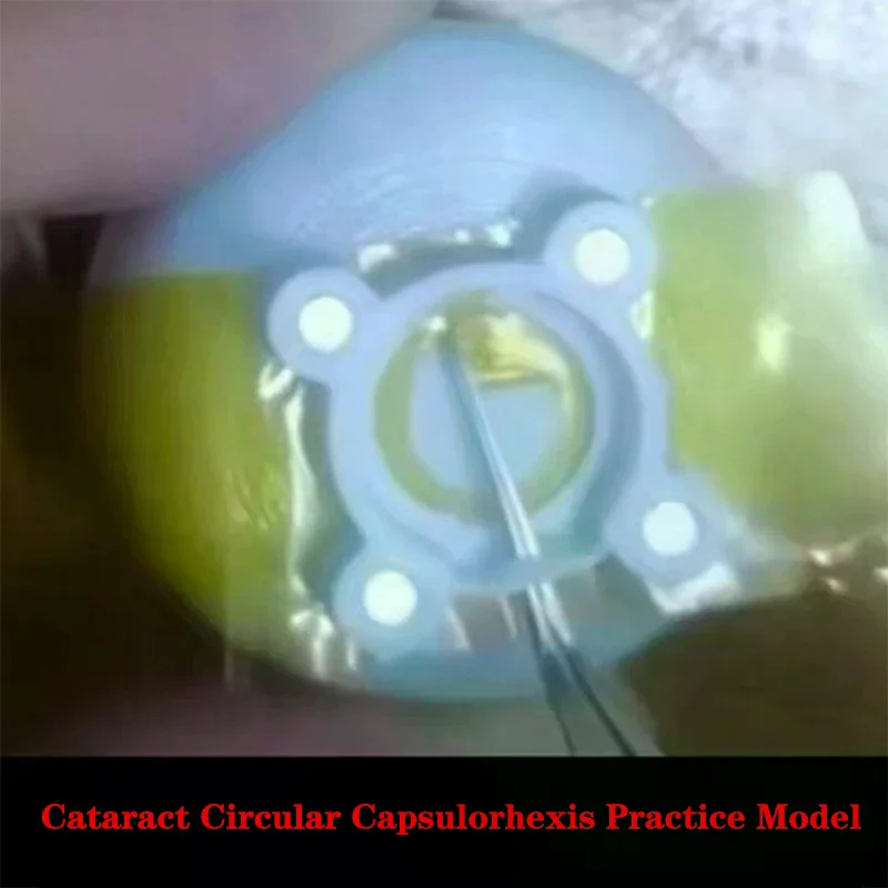 

2.0/3.0 Ophthalmology Phacoemulsification Capsulorhexis Forceps Circular Capsulorhexis Practice Model 1meter Film