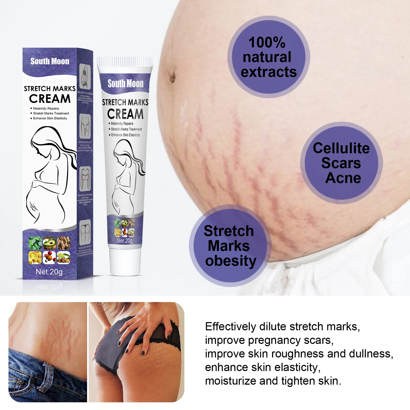 Crema de eliminación de marcas de embarazo, repara la piel dañada, ingredientes naturales, elimina la línea Abdominal del embarazo, sin manchas