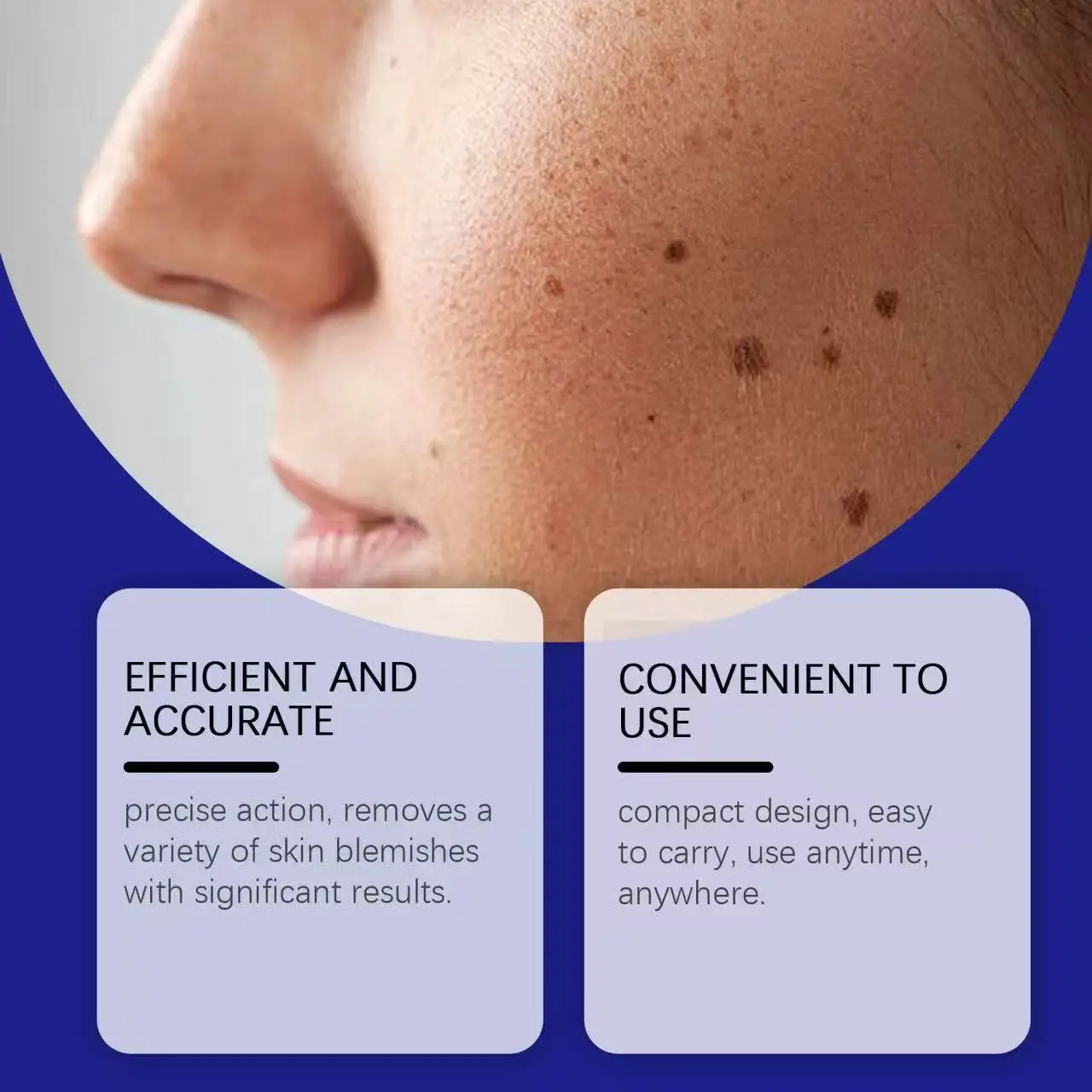 Blue Light Pen Maximum Strength Common and Plantar Wart Falling off warts care tool