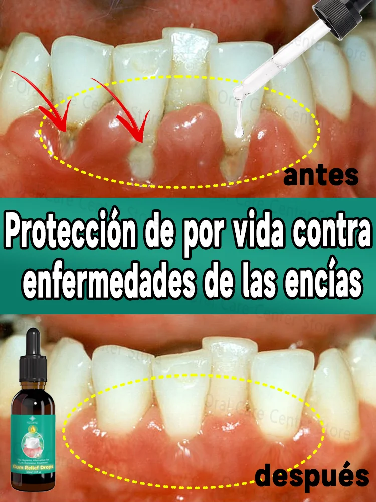 Proteja a saúde das gengivas, alivia rapidamente a dor de dente, repara gengivas danificadas e elimina o sangramento das gengivas