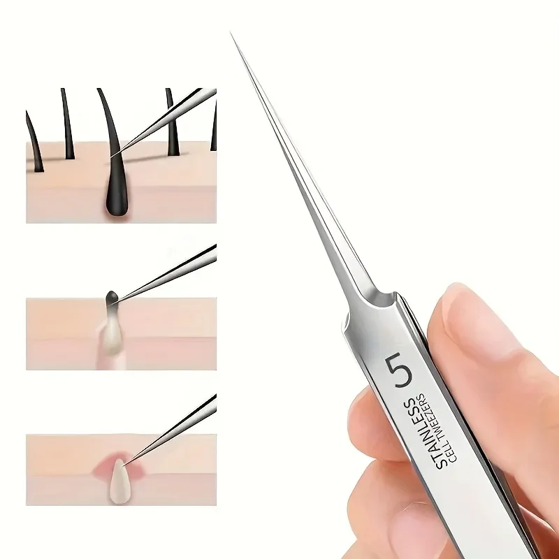 1pc Fine Tweezers For Removing Blackheads And Acne, Stainless Steel, Suitable For All Skin Types, No Fragrance