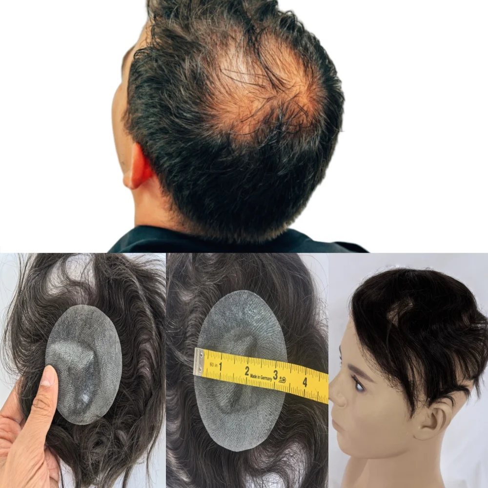 Men's Ultra-Thin 8x8cm PU Bald Spot Solution - European Hair Glue-On System, Medical Grade Hair Thickening Patch