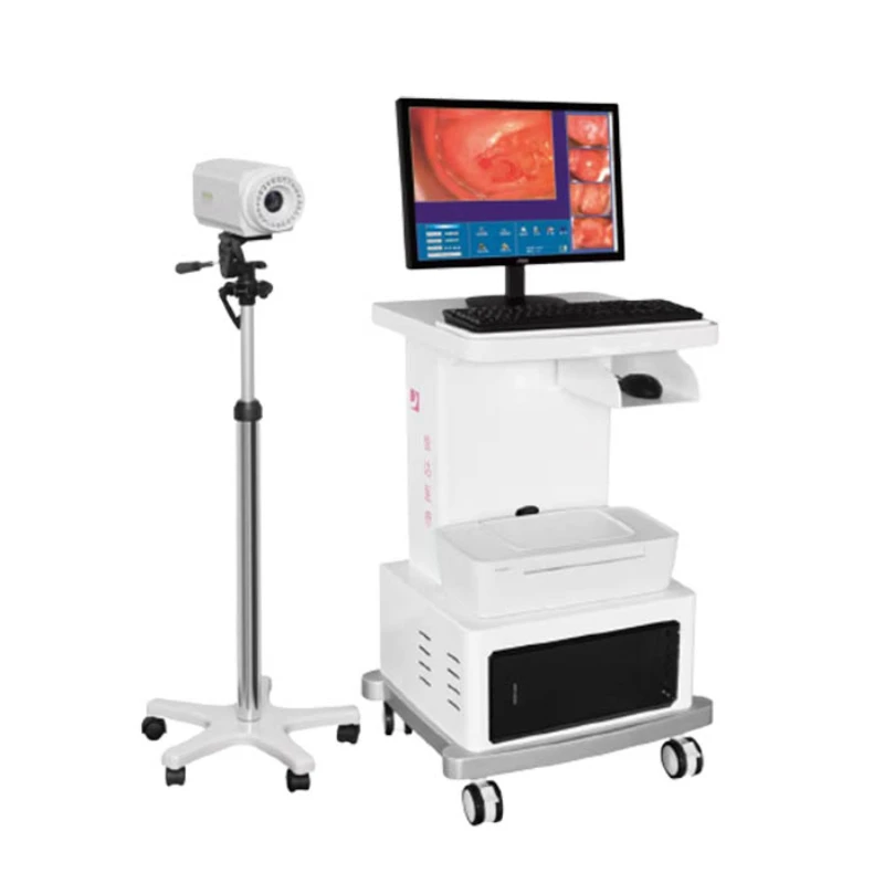 XD-6000Y digital electronic colposcope lens 300W pixels