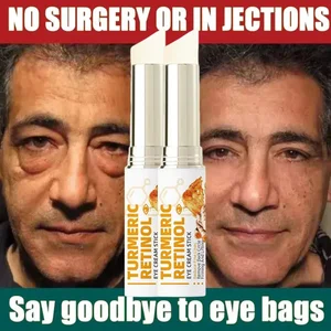 كريم العين الفوري للهالات السوداء ، مضاد للجزيئات الدهنية ، الهالات السوداء ، تلاشي الخطوط الدقيقة ، شد ، تفتيح ، الجمال الكوري ، العناية بالعيون أفضل 8 منتجات كورية للهالات السوداء مبيعا - رقم 1