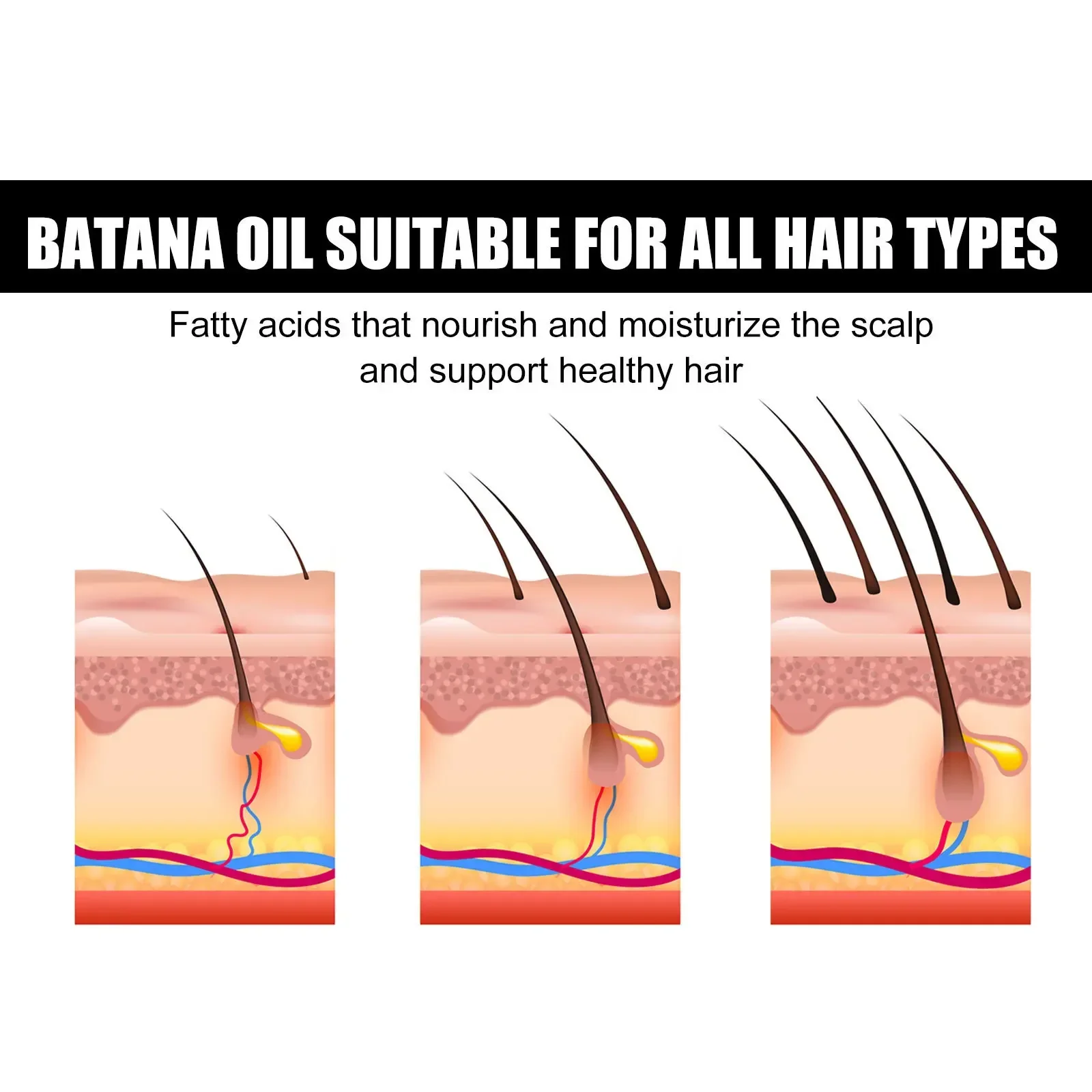 Sdatter African Batana Oil Hair Growth Spray Repair Baldness Hereditary Hair Loss Treatment moisturize the scalp aceite para el