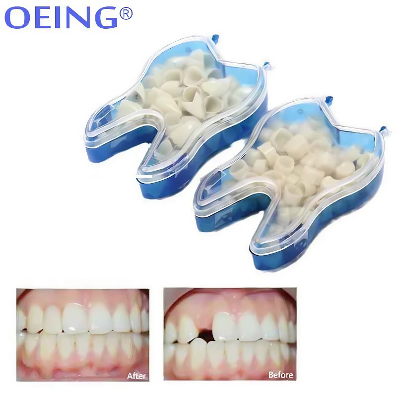 50Pcs/Box Dental Temporary Crown Kit Resin Front Molar Crowns Teeth Porcelain Anterior Posterior Veneers Dentist Tooth Whitening