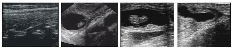 Machine légère d'ultrason de poignet de petite taille d'ussg de ferme de diagnostic médical de LHWV9 pour le vétérinaire