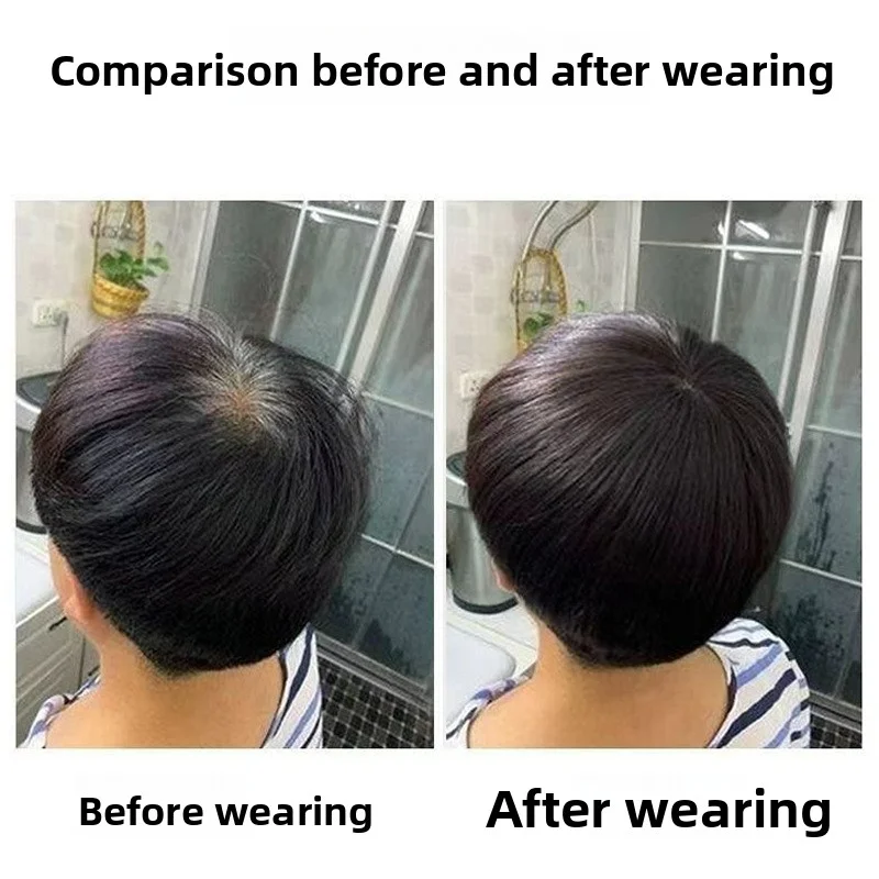 9x9 سنتيمتر قطعة شعر ريمي الشعر البشري الطبيعي السيدات توبر بسرعة زيادة حجم المبيعات للنساء ترقق الشعر وتغطية الشعر الرمادي #4