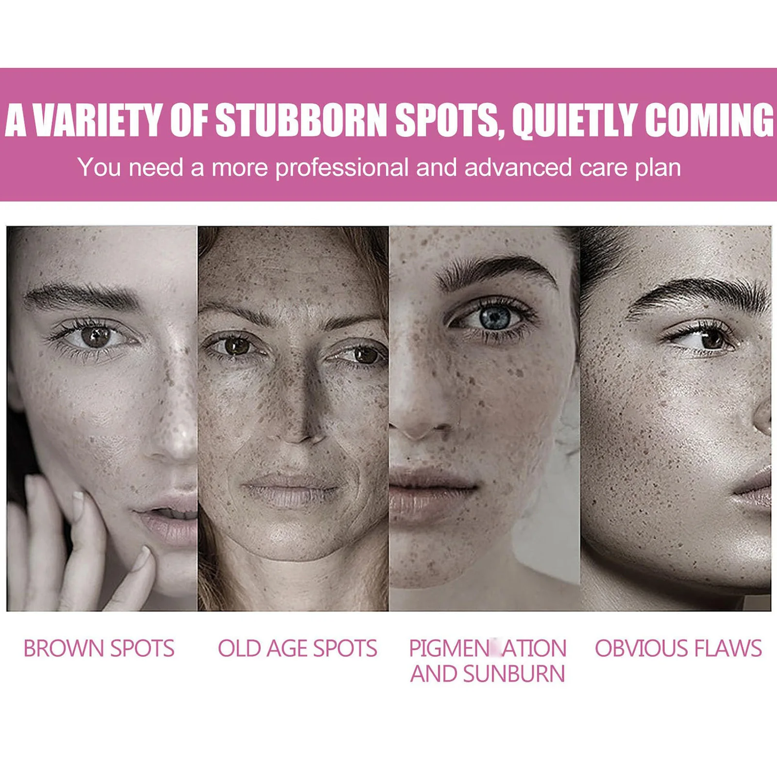 Dark Spot Remover for Face, Dark Spot Cream for Age Spot Sun Spot Freckles Melasma Brown Spot with Natural Formula, Dark Spot Co