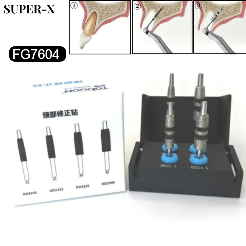 1Set New Dental Implant Guided Neck Correction Drills FG7604 High Quality Diamond Grinding Tools for Jawbone Precision Surgery