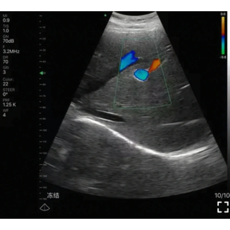 Ultrasound Scanner, 4D Color High Frequency Handheld Device With Double Probes Portable WIFI Wireless Imaging System