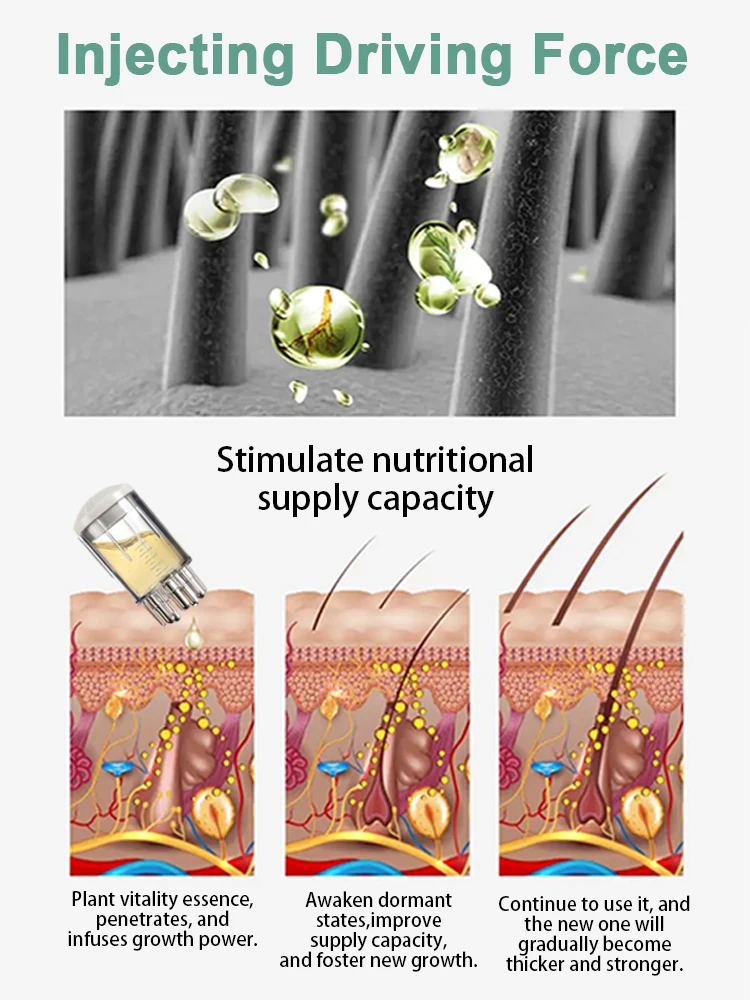 أداة تجديد بصيلات الشعر ذات تصنيف عالي، شحن مجاني #5