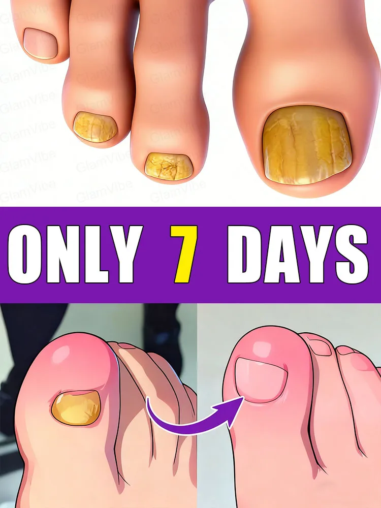 

Reduce anxiety and say goodbye to nail problems. Widely praised and highly favored.