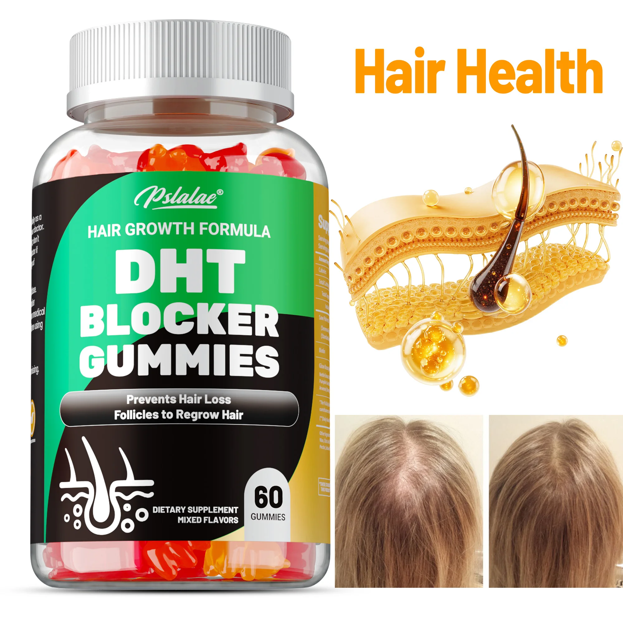 

DHT Blocker Gummies - Hair Growth Supplement, for Hereditary Thinning Hair - for Men and Women - 60 Capsules