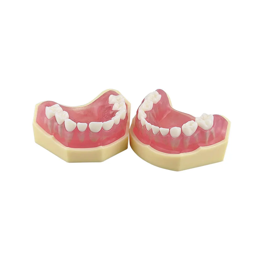 Kids Teeth Model For Training Practice Tooth Extraction Model Dental Standard Model With Removable Teeth Gums Children TYPODONT