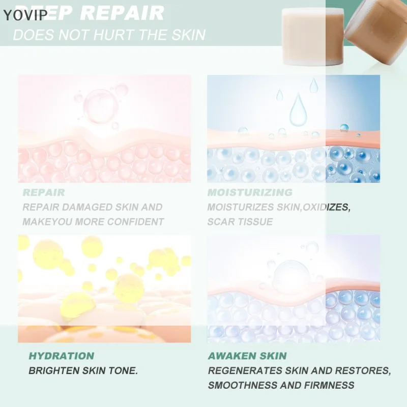 /YOV/150/300cm Silicone Scar Sheets Grade, Reusable Scar Tape For Keloid, C-Section, Surgery, Burn, Waterproof 1 Roll