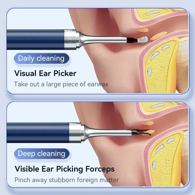 Pinzas limpiadoras de oídos con cámara, eliminación de cera de los oídos, otoscop con luz, cuchara de silicona para los oídos de 3,2mm, limpiador de oídos, pinzas visibles, limpieza