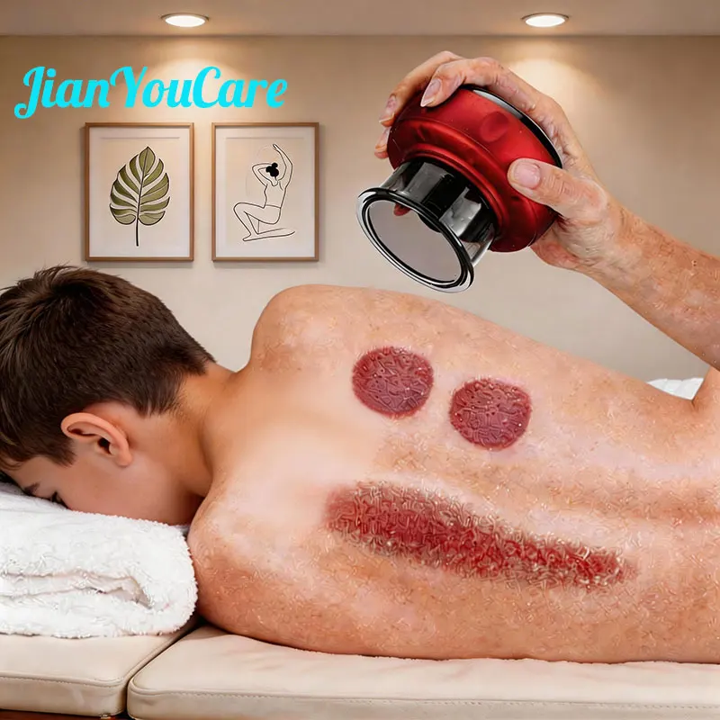 

JianYouCare Electric Vacuum Cupping Device skin Scraping Massager jars body Infrared Heating guasha Suction Cups Anti Cellulite