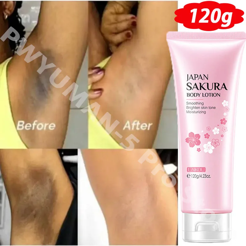 Body Whiten Cream Private Part Underarm Thigh Intimate Area Dark Skin Bleach Brighten Lotion Butt Knee Melanin Lighten Body Care