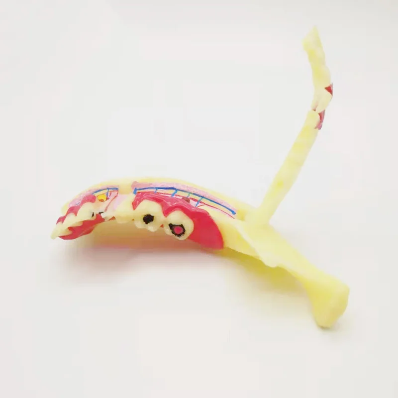 

1 шт., модель стоматологической эндодонтической лечебной ткани, анатомическая модель, исследование стоматолога, анатомия десен, уход за полостью рта, модель зубов