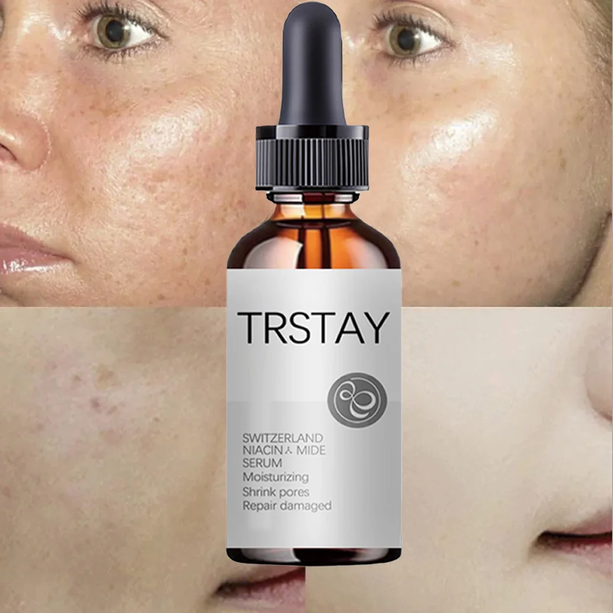 

TRSTAY Facial Essence Увлажняющий крем для минимизирования пор Кожный барьер Восстанавливающий уход за кожей для мам и детей