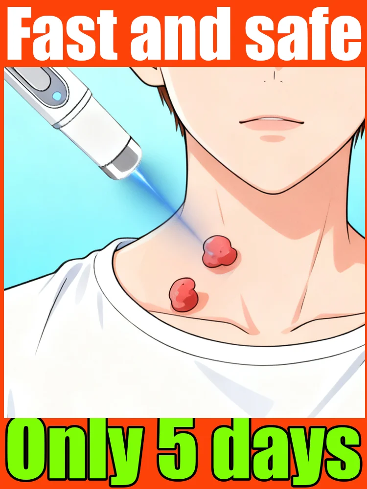 

Whether it's old or new warts, ᵃ ᵍᵉⁿᵗˡᵉ ᵗᵒᵘᶜʰ ʷⁱᵗʰ ᵗʰᵉ ˡᵃˢᵉʳ ᵖᵉⁿ ˡᵉᵃᵛᵉˢ ᵗʰᵉ ˢᵏⁱⁿ ᶜˡᵉ