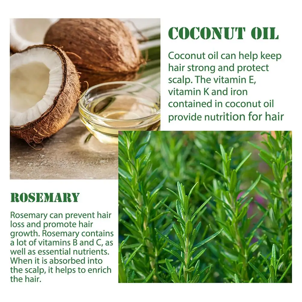 Rosemary Hair Care Essential Oil Nourishes Hair Roots Repairing Dense Hair Hair Solid Of 30/50/60ml Improvement Bifurcation A4H7