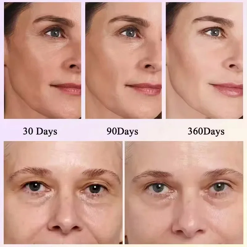 Copper Peptide Uglies: How I Fixed My Dull, Sagging Skin with Hoygi Blue  Copper Peptide Serum
