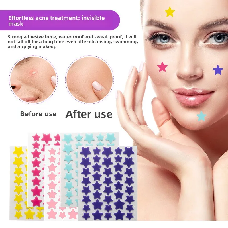 5 pezzi colorato stella acne patch migliorare la pelle delle donne idrocolloidale strumento per l'acne copertura invisibile dell'acne brufolo patch strumenti per la cura della pelle
