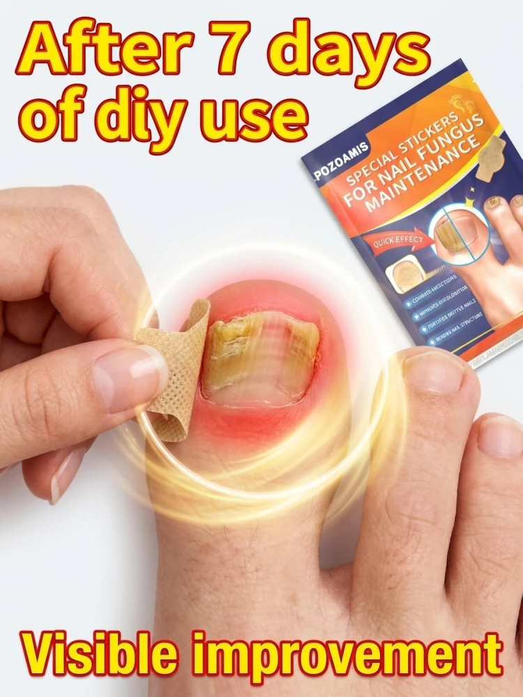 

Dᴇᴇᴘʟʏ ɴᴏᴜʀɪsʜᴇs ᴅʀʏ, ᴄʀᴀᴄᴋᴇᴅ ᴄᴜᴛɪᴄʟᴇs; sᴄᴜʟᴘᴛs ᴀɴ ᴇxᴏ̨ᴜɪsɪᴛᴇ, sᴏᴘʜɪsᴛɪᴄᴀᴛᴇᴅ ɴᴀɪʟ sʜᴀᴘᴇ