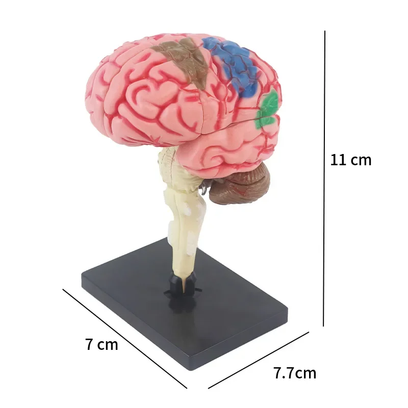 Ornements d'artisanat d'art de haute qualité, globe oculaire humain 4D, assemblage de modèle d'anatomie du cerveau bricolage pour l'école, étude anatomique fuchsia, science