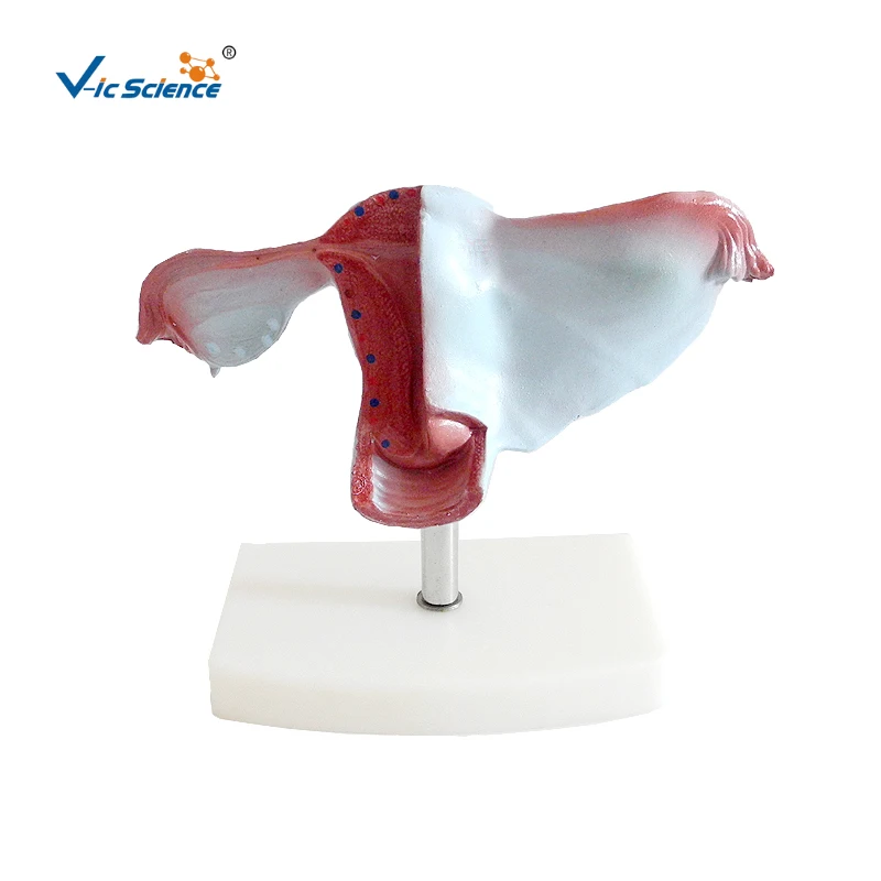 Natural Uterus Model Anatomical Model of Uterine Structure