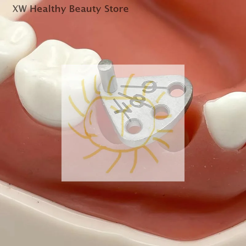 1pc Dental Implant Parallel Pin Gauge Stainless Steel Medical Locator Dental Implant Locating Guide Locating Ruler