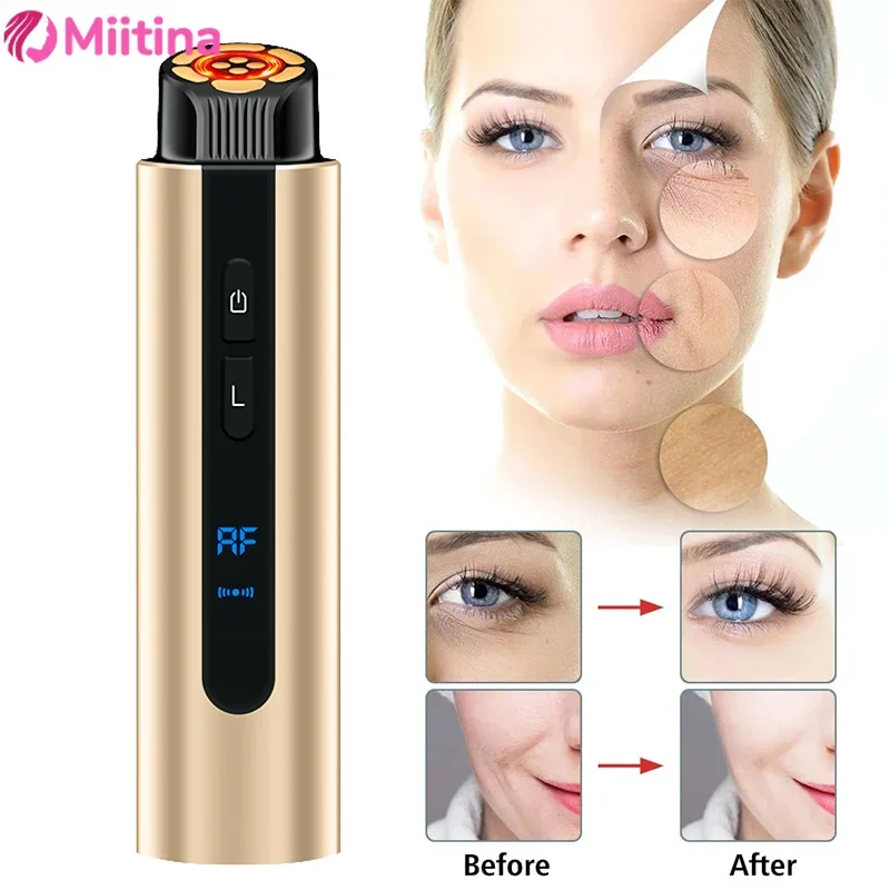 

Facial Radiofrequency Device EMS RF High Frequency Face Lifting Massager Anti-aging Skin Rejuvenation Facial Microcurrent Care