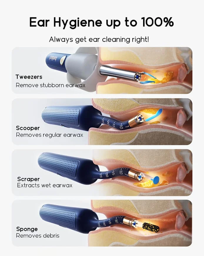 2025 New Bebird Earsight Plus I35R Ear Wax Removal Tool Camera Cleaner Kit- HD Wireless Flexible Otoscope, Pain-Free Ear Tweezer