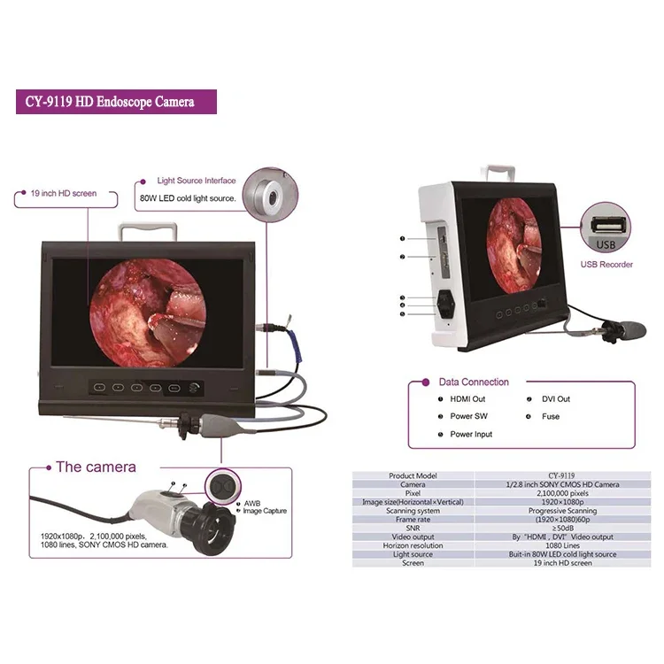 hysteroscopes Laparoscopes Gynecological  video endoscopes camera - Image 6