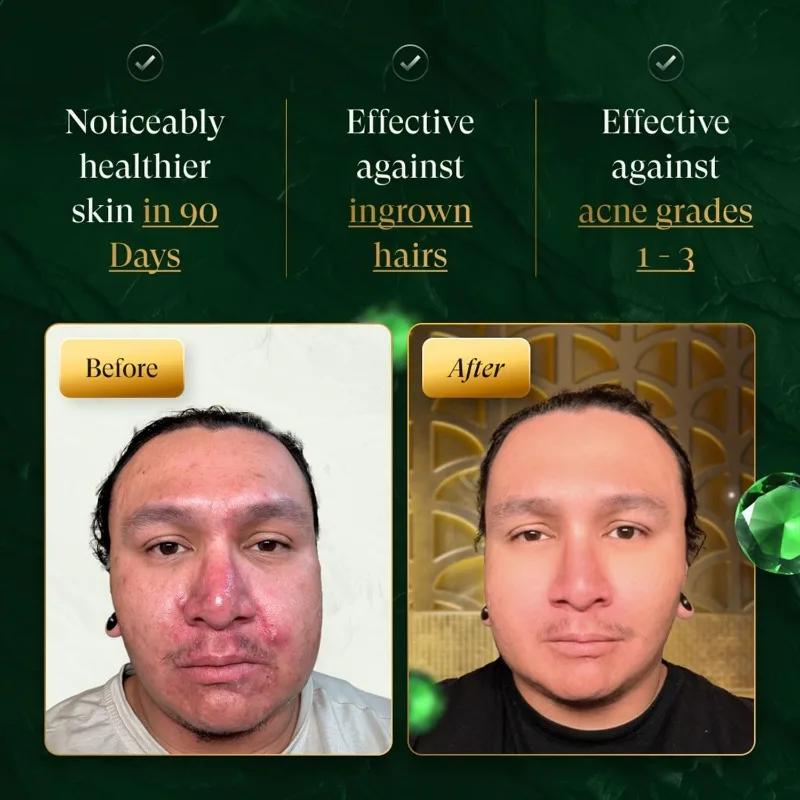 douxds Flex™ Pro Vibrating Face Brush, Electric Scrubber, Scrubber for Men, Flex™ Brush, Men's Skin Care