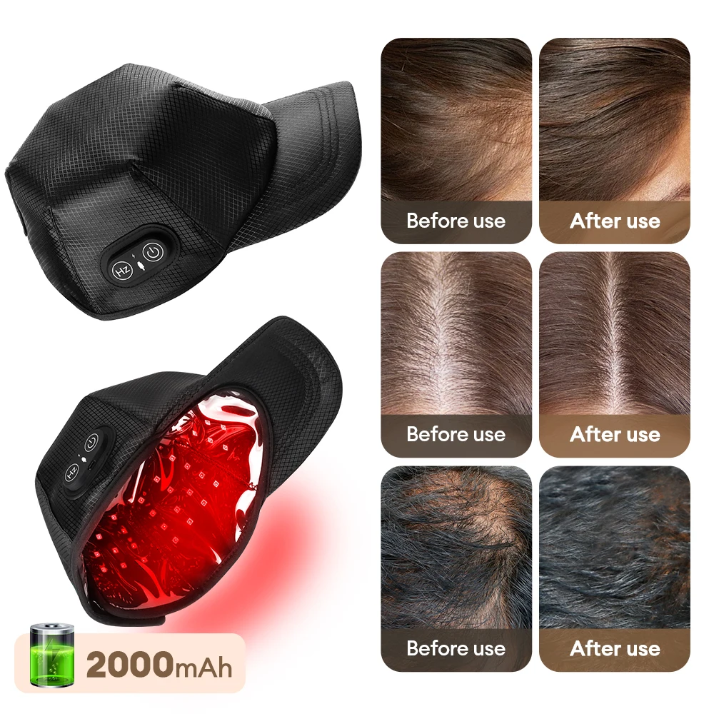 Infrared Red Light Hair Growth Cap 650nm+850nm Hair Loss Treatment Hat Anti Hair Loss Restore Hair Thickness Hair Regrowth Care