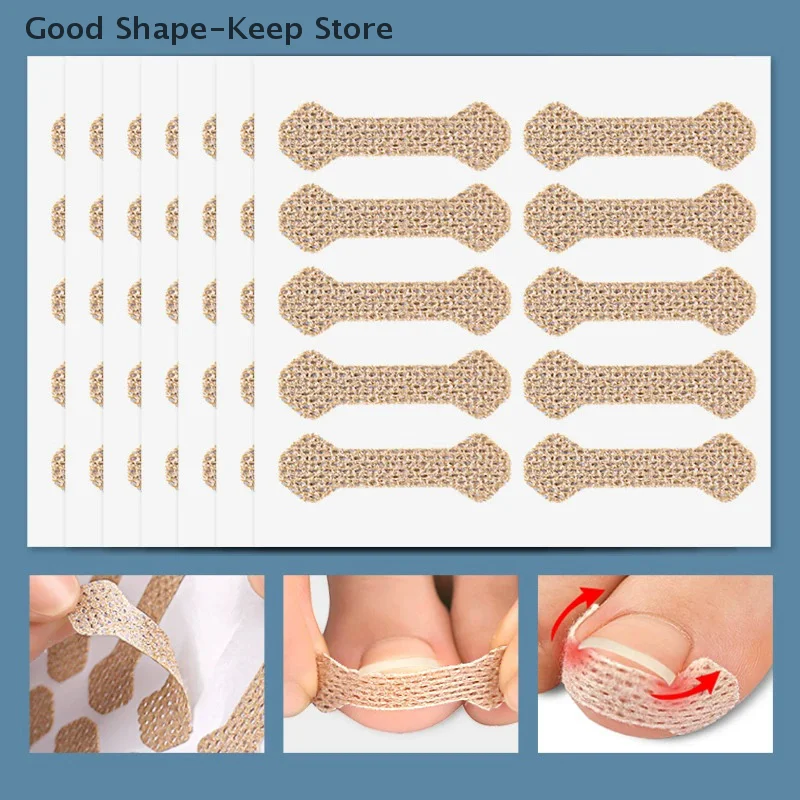 60 قطعة شرائط مصحح أظافر نام مكافحة مسمار التصحيح وسادة تو طويلة لداحس العناية بالقدم النوم مسمار التصحيح الأظافر في اللحم