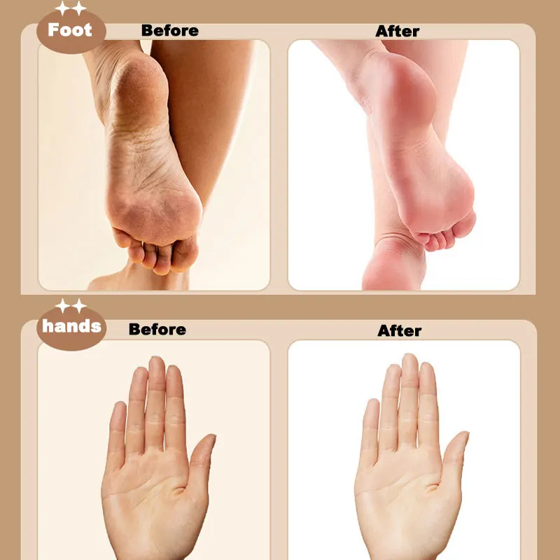 3 em 1 arquivo de pé elétrico removedor de calos de pele morta ferramenta de cuidados com os pés removedor de calos de pele grossa seca 3 velocidades de engrenagem recarregável