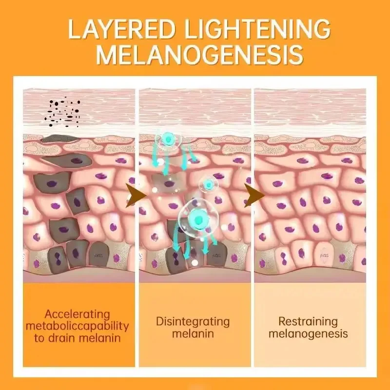 Crème blanchissante anti-taches d'astragale, éclaircit la peau rapidement, élimine la pigmentation de la mélanine, les taches foncées du mélasma, hydrate les soins pour la peau