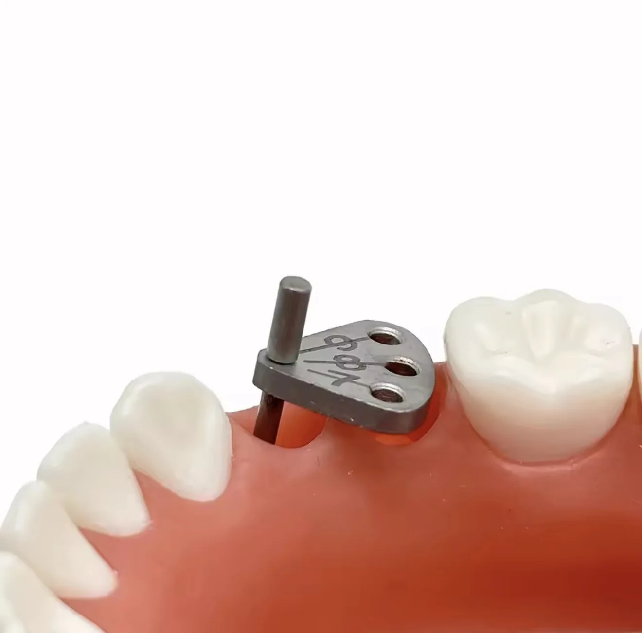 DENILK 1pc Dental implant Parallel Pin Gauge Stainless Steel Medical Lacator Dental Implant Locatring Guide Locating Ruler - view 3