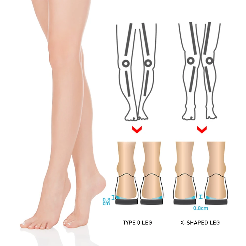 Medial Lateral Heel Wedges Gel Adhesive Soft Shoe Insoles Corrective Shoe Inserts For Foot Alignment O X‑Type Leg Corrector